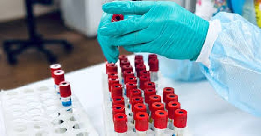 ലക്ഷണങ്ങൾ പ്രത്യക്ഷപെടുന്നതിന് മുൻപ് തന്നെ  ഫാറ്റി ലിവർ സാധ്യത കണ്ടെത്താമെന്ന് പുതിയ പഠനം