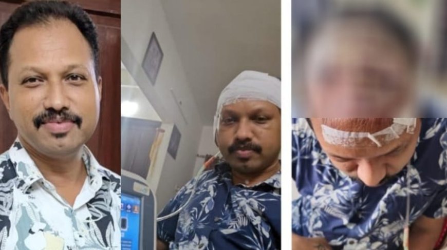 മാംസം ഭക്ഷിക്കുന്ന ബാക്ടീരിയ തലയിൽ: ഹെയർ ട്രാൻസ്‌പ്ലാന്റ് ചെയ്ത യുവാവിന് ദാരുണ ജീവിതം